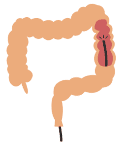大腸のイラスト